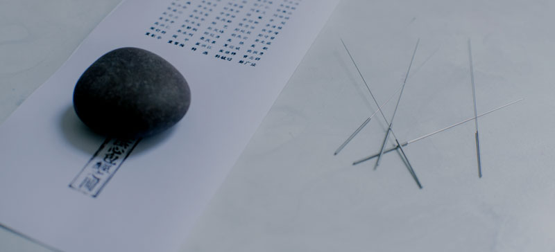 acupuncture-89